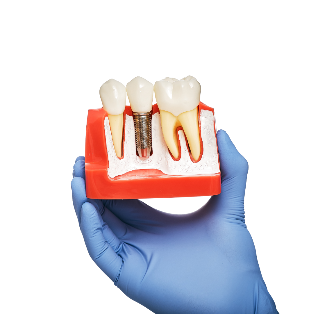 ANK-Dental-Tedavi