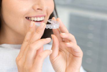 Şeffaf Plak (Telsiz Ortodonti, Invisalign) Tedavisi Nedir?