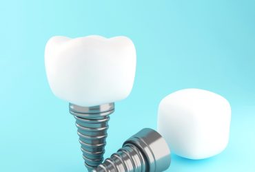 Diş Eksikliğinde Altın Standart – İmplant